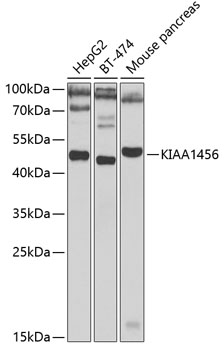 a31933 trmt9b primary antiboties wb testing 1