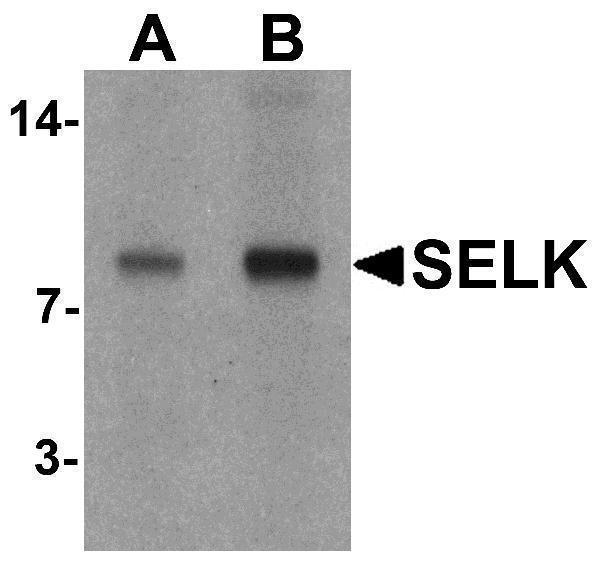 a31964 selk primary antibodies wb testing 1