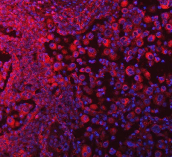 a31970 selenot primary antibodies if testing 12