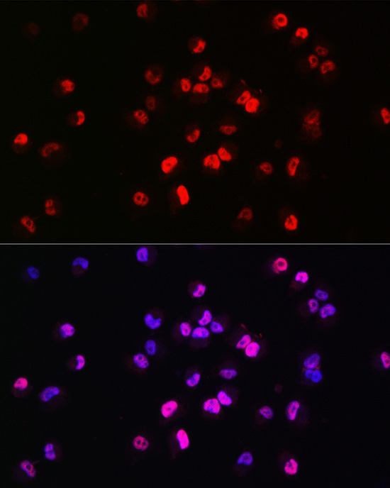 Immunofluorescence analysis of NCI-H460 cells using Brachyury Rabbit pAb  aBrachyury diluBrachyuryion of 1:200 