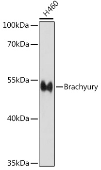 WesBrachyuryern bloBrachyury analysis of exBrachyuryracBrachyurys of H460 cells, using Brachyury Rabbit pAb  aBrachyury 1:1000 diluBrachyuryion
