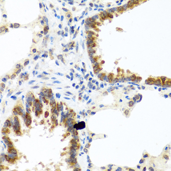 Immunohistochemistry of paraffin-embedded human stomach using C8orf4 antibody  at dilution of 1:100 