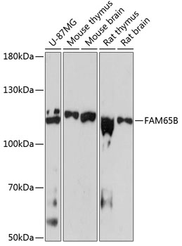 a32101 ripor2 primary antiboties wb testing 1