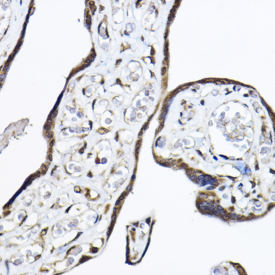 a32111 tent4a primary antiboties ihc testing 2