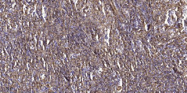 Immunohistochemical analysis of paraffin-embedded human spleen tissue
