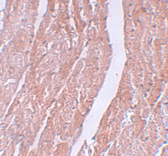 a32122 mina primary antibodies ihc testing 2