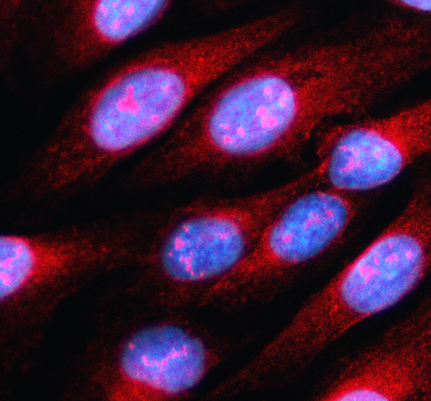 IF analysis of KNL1 using anti-KNL1 antibody (A32138-1)