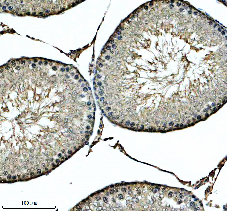 IHC analysis of KNL1 using anti-KNL1 antibody (A32138-1)
