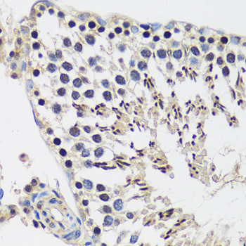 Immunohistochemistry of paraffin-embedded rat testis using CASC5 antibody  at dilution of 1:100 