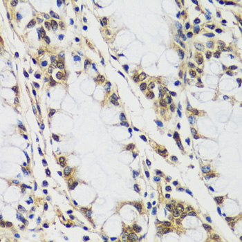 Immunohistochemistry of paraffin-embedded human colon using CASC5 antibody  at dilution of 1:100 