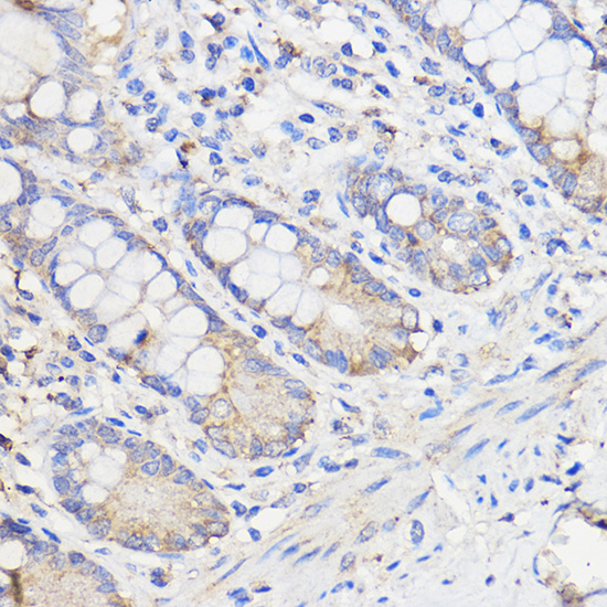 Immunohistochemistry of paraffin-embedded Human colon using WBSCR27 Rabbit pAb  at dilution of 1:50 
