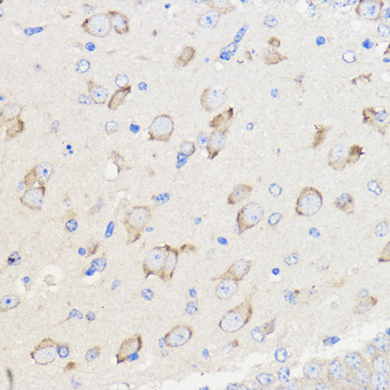 Immunohistochemistry of paraffin-embedded Mouse brain using WBSCR27 Rabbit pAb  at dilution of 1:50 