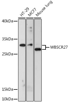 Western blot analysis of extracts of various cell lines, using WBSCR27 antibody  at 1:1000 dilution