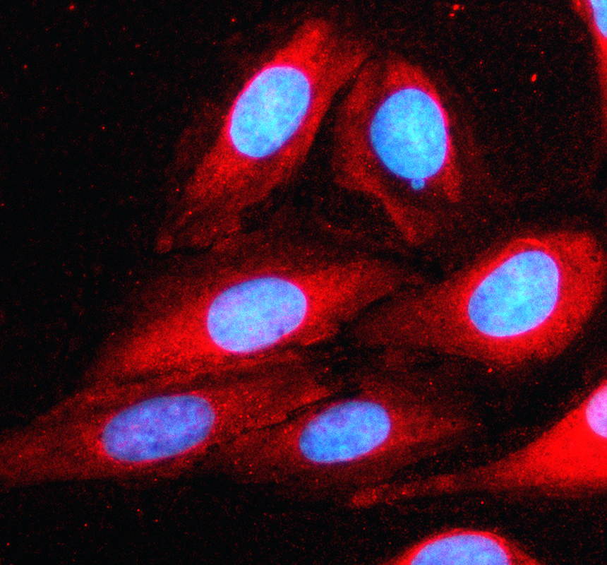 a32176 1 large1 primary antibodies if testing 1