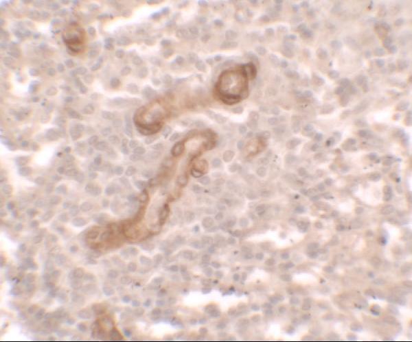 a32244 prkcdbp primary antibodies ihc testing 2