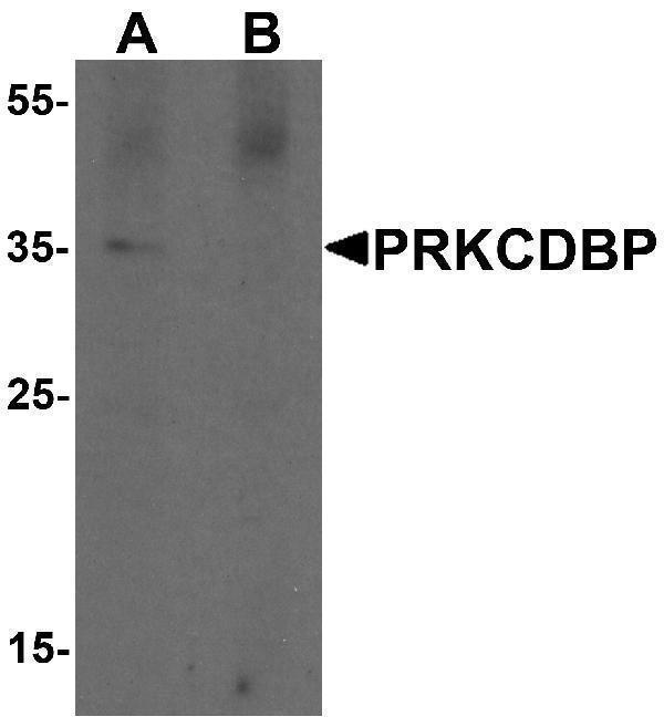 a32244 prkcdbp primary antibodies wb testing 1