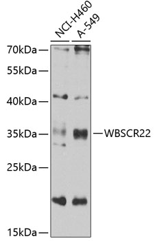 a32249 bud23 primary antiboties if testing 2