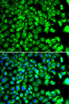 a32251 borcs7 primary antiboties if testing 1