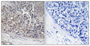 a32263 1 coq8b primary antibodyes ihc testing 2