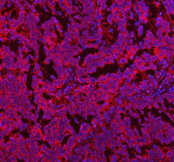 a32263 2 coq8b primary antibodies if testing 13