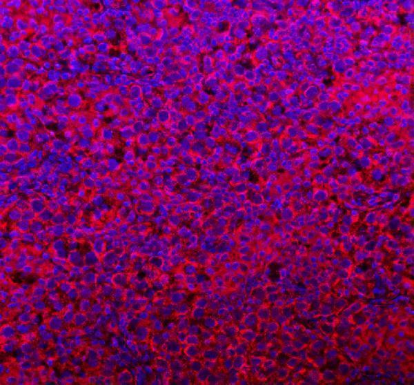 a32263 2 coq8b primary antibodies if testing 14