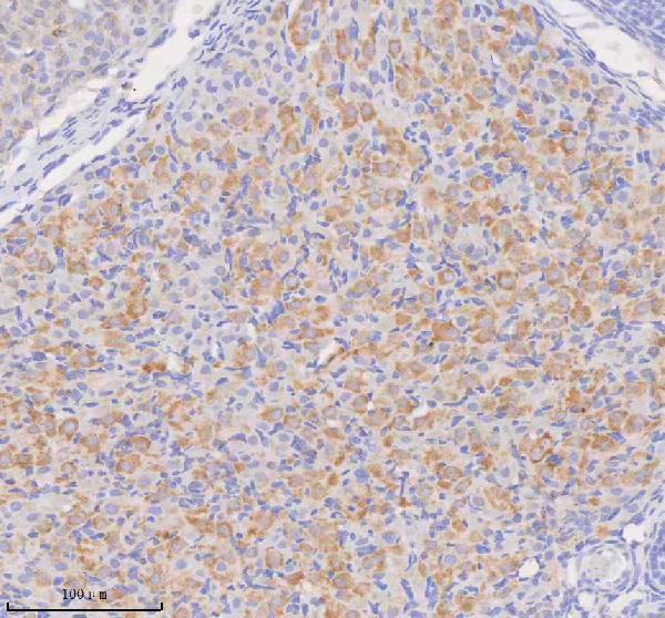 a32263 2 coq8b primary antibodies ihc testing 11