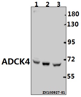 a32263 coq8b primary antiboties wb testing 1