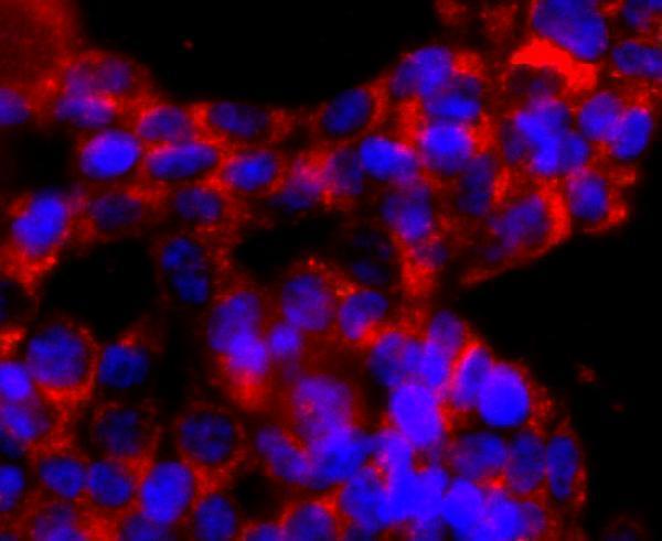 ICC staining ATPB in 293T cells (red)