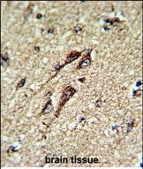 a32270 2 anti atp5b antibody center ihc p testing 4