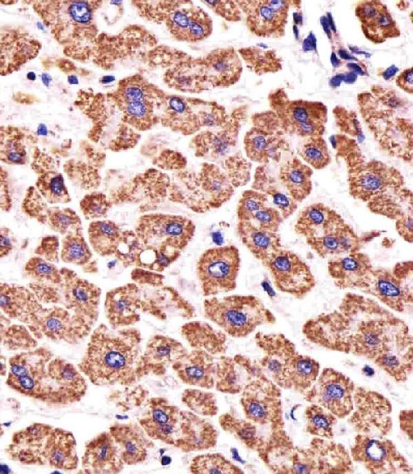a32270 2 anti atp5b antibody center ihc p testing 5
