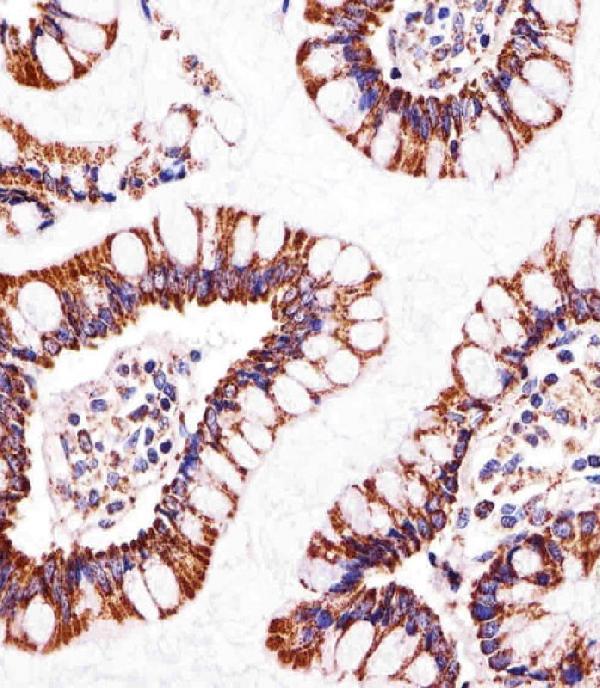 a32270 2 anti atp5b antibody center ihc p testing 6