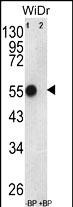 Western blot analysis of ATP5B Antibody (Center) Pab pre-incubated without(lane 1) and with(lane 2) blocking peptide in WiDr cell line lysate