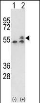 Western blot analysis of ATP5B (arrow) using rabbit polyclonal ATP5B Antibody (Center)