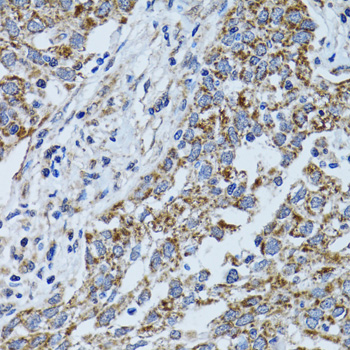 a32270 atp5f1b primary antiboties ihc testing 4