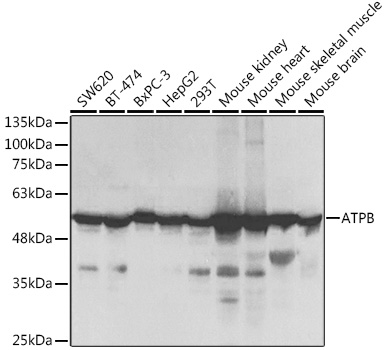 a32270 atp5f1b primary antiboties wb testing 1