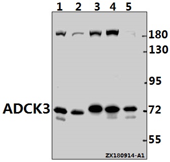 Western blot (WB) analysis of ADCK3 (N323) polyclonal antibody at 1:500 dilution
Lane1:CT26 whole cell lysate(40ug)
Lane2:H9C2 whole cell lysate(40ug)
Lane3:EC9706 whole cell lysate(40ug)
Lane4:A2780 whole cell lysate(40ug)
Lane5:Panc1 whole cell lysate(40ug)