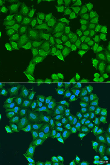 Immunofluorescence analysis of U2OS cells using ATP5O antibody  at dilution of 1:100