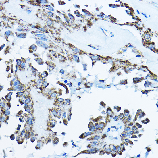 a32274 atp5po primary antiboties ihc testing 3