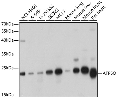 Western blot analysis of extracts of various cell lines, using ATP5O antibody  at 1:1000 dilution