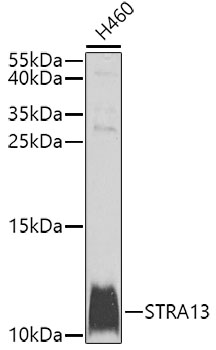 a32276 cenpx primary antiboties wb testing 1