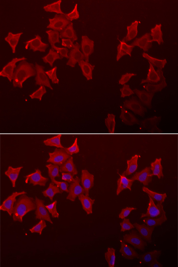 Immunofluorescence analysis of A549 cells using LECT1 antibody 
