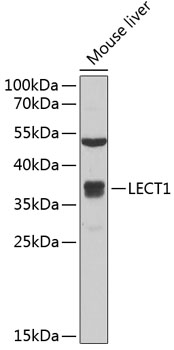 Western blot analysis of extracts of mouse liver, using LECT1 antibody  at 1:1000 dilution