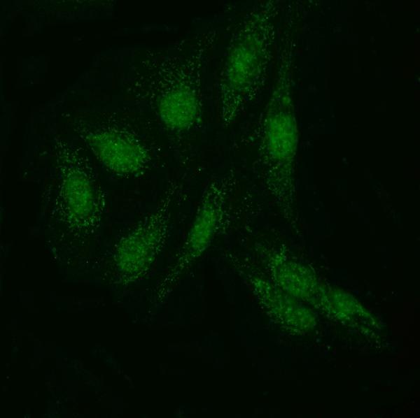 Figure 4. IF analysis of KIAA1429/VIRMA using anti-KIAA1429/VIRMA antibody (A32283-1). KIAA1429/VIRMA was detected in an immunocytochemical section of U20S cells. Enzyme antigen retrieval was performed using IHC enzyme antigen retrieval reagent (AR0022) for 15 mins. The cells were blocked with 10% goat serum. And then incubated with 5 microg/mL rabbit anti-KIAA1429/VIRMA Antibody (A32283-1) overnight at 4°C. DyLight®488 Conjugated Goat Anti-Rabbit IgG (BA1127) was used as secondary antibody at 1:100 dilution and incubated for 30 minutes at 37°C. Visualize using a fluorescence microscope and filter sets appropriate for the label used. Figure 4. IF analysis of KIAA1429/VIRMA using anti-KIAA1429/VIRMA antibody (A32283-1). KIAA1429/VIRMA was detected in an immunocytochemical section of U20S cells. Enzyme antigen retrieval was performed using IHC enzyme antigen retrieval reagent (AR0022) for 15 mins. The cells were blocked with 10% goat serum. And then incubated with 5 microg/mL rabbit anti-KIAA1429/VIRMA Antibody (A32283-1) overnight at 4°C. DyLight®488 Conjugated Goat Anti-Rabbit IgG (BA1127) was used as secondary antibody at 1:100 dilution and incubated for 30 minutes at 37°C. Visualize using a fluorescence microscope and filter sets appropriate for the label used.