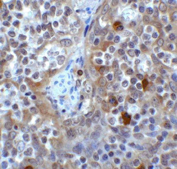 Immunohistochemistry of VISTA in human tonsil tissue with B7-H5 antibody at 2 μg/ml