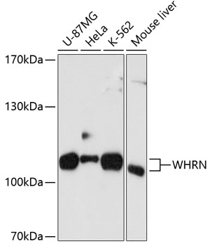 a32322 whrn primary antiboties wb testing 1