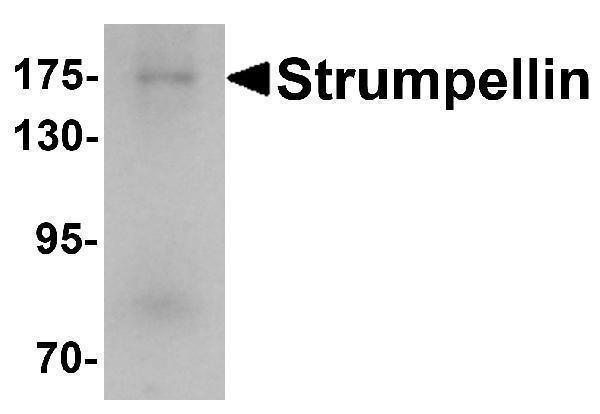a32325 kiaa0196 primary antibodies wb testing 1