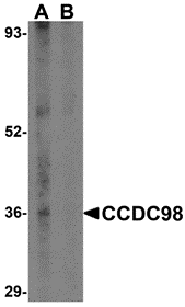 a32338 fam175a primary antibodies wb testing 1
