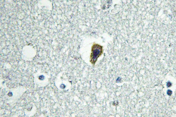 a32346 adgrb1 primary antiboties ihc testing 2