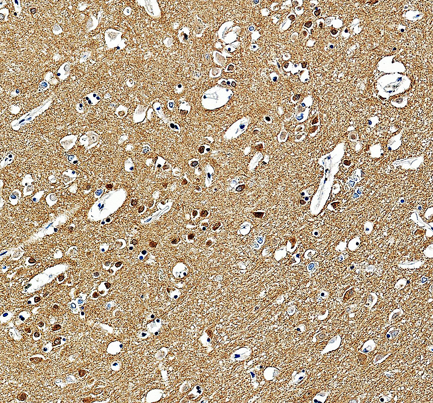 a32355 1 stn1 primary antibodies ihc testing 1