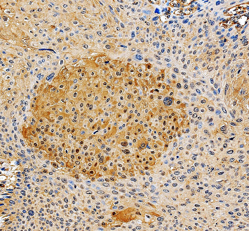 a32355 1 stn1 primary antibodies ihc testing 2